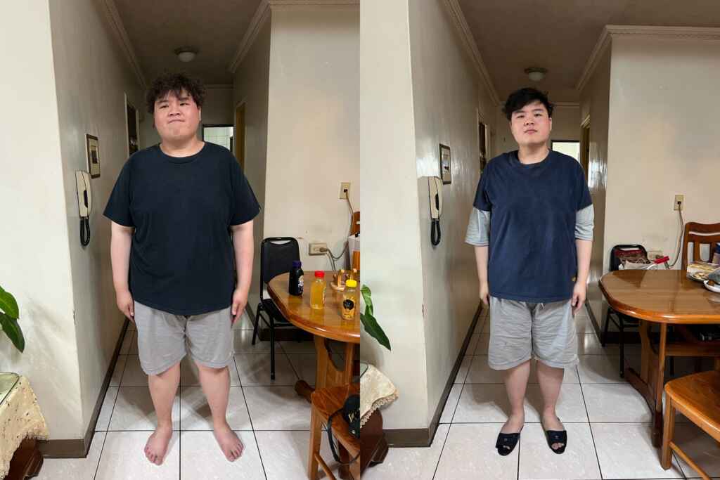 ▲33歲的林先生因為長期久坐、飲食不規律的習慣,體重一路飆升至142公斤,在與減重團隊討論後選擇了胃鏡縮胃手術(ESG),術後僅四個月,林先生已經減輕22公斤。(中醫大附醫提供)