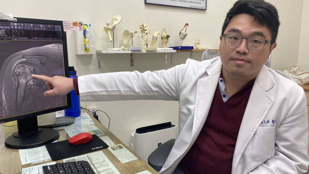 ▲70歲患者右肩三根肌腱斷裂，肱骨也已壞死。（員榮醫院提供）