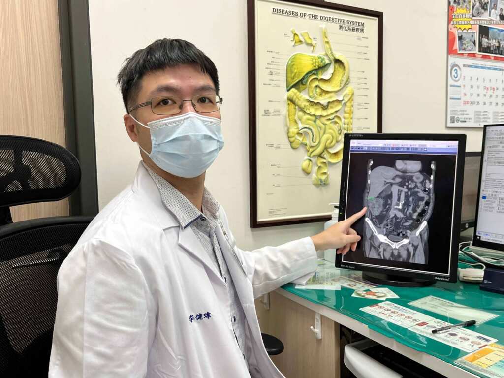 ▲李健瑋醫師指著掃描影像解說。病例顯示,非典型症狀如貧血亦可能為大腸癌警訊,提醒民眾重視篩檢。(員基醫院提供)