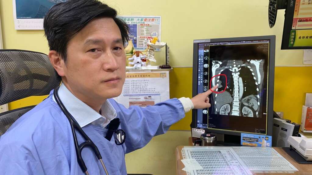 ▲員榮醫療體系員榮醫院醫療副院長涂川洲表示，患者感上類鼻疽菌，肺部有兩處膿瘍（圖中紅圈處）。（員榮醫院提供）