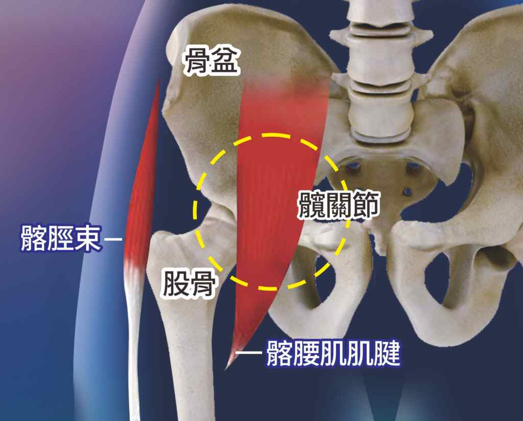 ▲七十歲老阿伯因劈腿，髖關節位置受傷(圖中打黃圈處 )_，接受PRP及高濃度葡萄糖針劑治療，第二天腿就能抬起來。（員榮醫院提供）